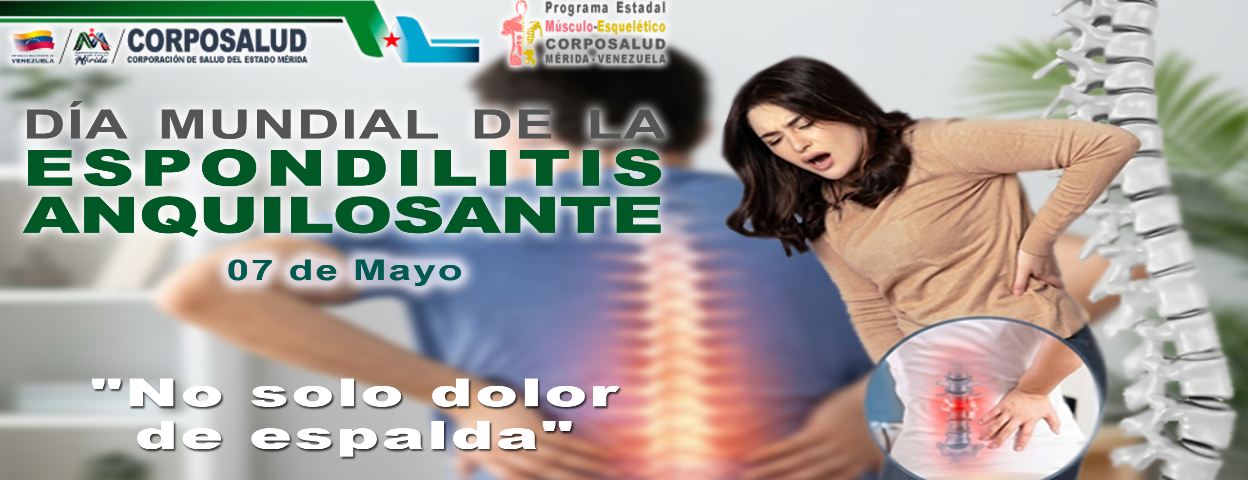 BANNER DÍA MUNDIAL DE LA ESPONDILITIS copy